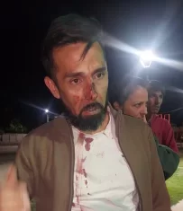 Rawson: un comerciante y su familia sufrieron una violenta agresión