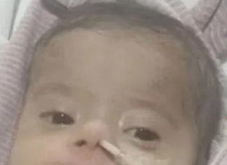 Falleció Emilia, la bebé que esperaba una cirugía cardíaca